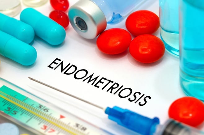 Endometriosis infertility and IVF 