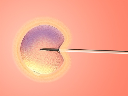 What is ICSI with IVF