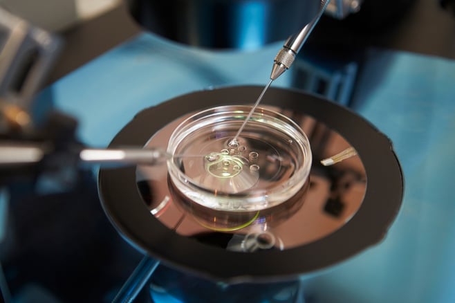 Image result for IVF
