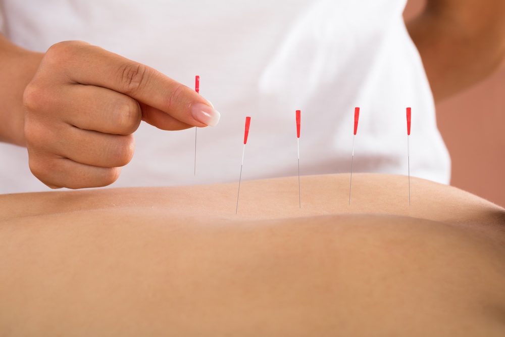 acupuncture_help_get_pregnant.jpg